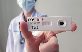 covid rapid test antigenski